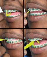 Ortho Floss| Flossers for Braces| Floss Dental Picks Fits Between Brace Wire and Teeth| Quick and Easy Braces Floss|50 Count Bag |Pack of 4 Bonus 4 Interdental Brush